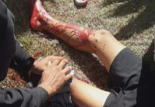 Adolescente ferido por linha chilena em Betim vai ter a perna amputada