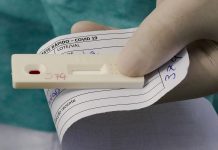 Novo teste de diagnóstico para covid-19 é aprovado pela Anvisa